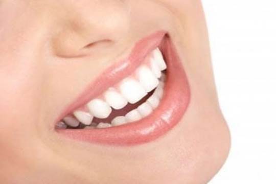 Consejos para blanquear los dientes